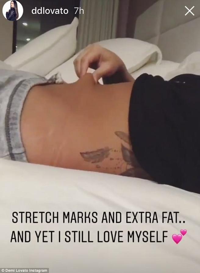 Demi Lovato Shows Her Cellulite And Her Stretch Marks HollywoodGossip