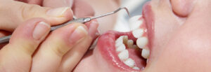 Affordable Teeth Root Canal Services Near Me at ToothCorner